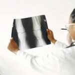 نذكر في هذا المقال أسعار عمليات العظام واستبدال المفاصل للركب والحوض والكتف لدى مستشفيات الهند، مومباي، بنغالور، تشيناي، حيدر أباد، دلهي، كيرلا، كوتشي، كاليكوت